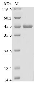 Recombinant Paeniclostridium sordellii Sialidase