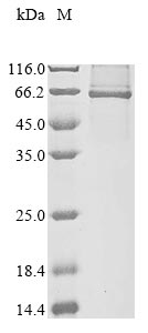 Recombinant Human E3 ubiquitin-protein ligase RNF8 (RNF8)