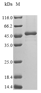 Recombinant Human Melanoma-associated antigen B2 (MAGEB2)