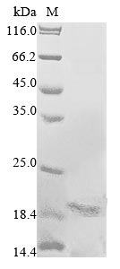 Recombinant Culex quinquefasciatus Odorant-binding protein 56e (6050687)