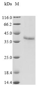 Recombinant Human adenovirus B serotype 11 Fiber protein (L5)