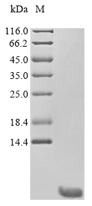 Recombinant Human Calcitonin (CALCA)