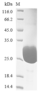 Recombinant Human Gastrin-releasing peptide (GRP), partial