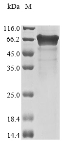 Recombinant Human YTH domain-containing family protein 1 (YTHDF1)