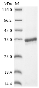 Recombinant Rat Endothelin-1 (Edn1), partial
