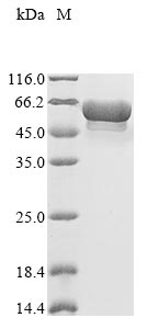 Recombinant Helicobacter pylori 60 kDa chaperonin (groL), partial