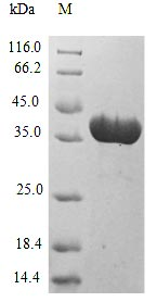 Recombinant Aspergillus fumigatus Superoxide dismutase [Mn], mitochondrial (sodB)