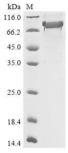 Recombinant Human Semaphorin-3B (SEMA3B)