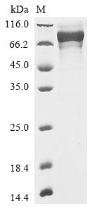 Recombinant Rabbit Dystroglycan (DAG1), partial