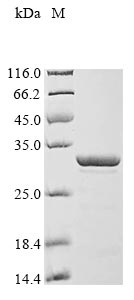 Recombinant Human Thymosin beta-10 (TMSB10)
