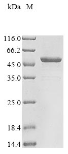 Recombinant Human Gasdermin-B (GSDMB)