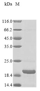 Recombinant Macaca fascicularis Parathyroid hormone (PTH)
