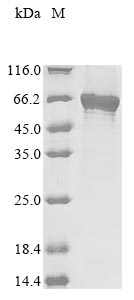 Recombinant Human Polypeptide N-acetylgalactosaminyltransferase-like 6 (GALNTL6), partial
