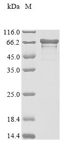 Recombinant Human La-related protein 6 (LARP6)