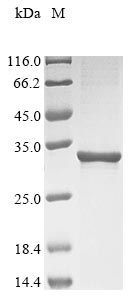 Recombinant Human ATP synthase F (0) complex subunit B1, mitochondrial (ATP5PB)