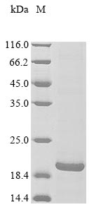 Recombinant Human Blood group Rh (CE) polypeptide (RHCE), partial