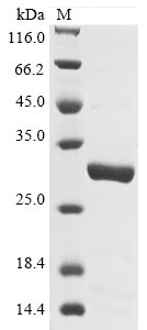 Recombinant Pongo abelii Lysosome-associated membrane glycoprotein 5 (LAMP5), partial