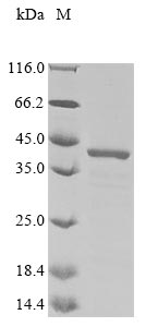 Recombinant Human Golgi phosphoprotein 3 (GOLPH3)