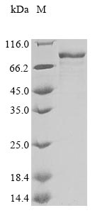 Recombinant Human ADP-ribosylation factor-binding protein GGA3 (GGA3)