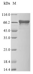 Recombinant Human Coiled-coil domain-containing protein 6 (CCDC6)