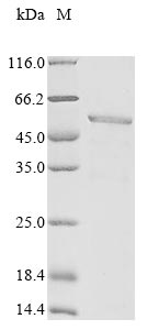 Recombinant Human Melanoma-associated antigen 4 (MAGEA4) (A173T)