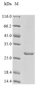Recombinant Human Myocardin-related transcription factor A (MRTFA), partial
