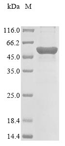 Recombinant Human Beta-hexosaminidase subunit beta (HEXB)