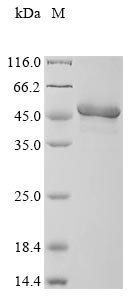 Recombinant Human Dual specificity protein phosphatase 6 (DUSP6)