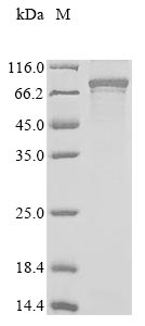 Recombinant Human Protein CBFA2T1 (RUNX1T1)