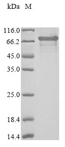 Recombinant Human Isthmin-2 (ISM2), partial