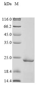 Recombinant Human Parathymosin (PTMS)