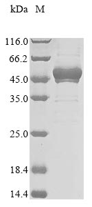 Recombinant Human Splicing factor 3B subunit 3 (SF3B3) (T899I), partial