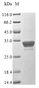 Recombinant Mycoplasma pneumoniae Mgp-operon protein 3, partial