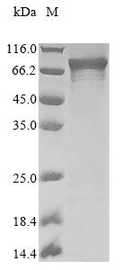 Recombinant Human Endogenous retrovirus group K member 5 Gag polyprotein (ERVK-5)
