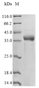 Recombinant Toxoplasma gondii Major surface antigen p30