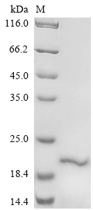 Recombinant Human Delta-like protein 3 (DLL3), partial