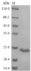 Recombinant Human B-cell receptor CD22 (CD22), partial