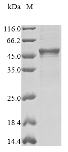Recombinant Rat Serine protease inhibitor A3K (Serpina3k)