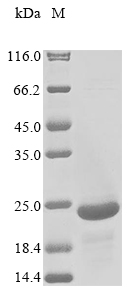Recombinant African swine fever virus Inner membrane protein p54, partial