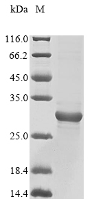 Recombinant Pan troglodytes Adrenomedullin (ADM)