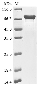 Recombinant Human YTH domain-containing family protein 1 (YTHDF1)
