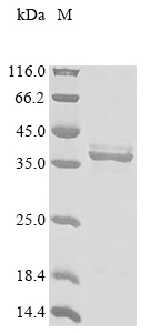 Recombinant Rat Erythropoietin receptor (Epor), partial