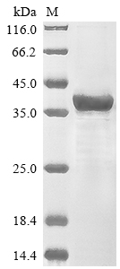 Recombinant Human Protein patched homolog 2 (PTCH2), partial