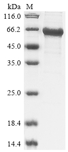 Recombinant Human E3 ubiquitin-protein ligase RNF8 (RNF8)