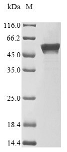 Recombinant Human DnaJ homolog subfamily A member 1 (DNAJA1)
