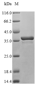 Recombinant Human immunodeficiency virus type 1 group M subtype C Protein Rev (rev)