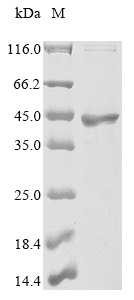Recombinant Human Ras GTPase-activating protein 1 (RASA1), partial