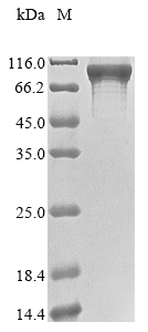Recombinant Human Signal recognition particle subunit SRP72 (SRP72)