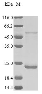 Recombinant Rat Alpha-1-acid glycoprotein (Orm1)