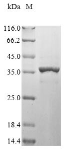 Recombinant Astacus leptodactylus Troponin I